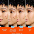 Bioré Paint & Peel Liquid Pimple Patch with Salicylic Acid – Invisible Acne Spot Treatment